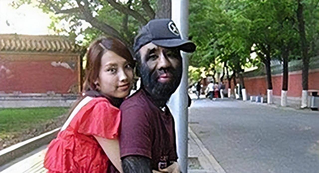 原创当年轰动一时的毛孩42岁娶90后娇妻生下一子未遗传长毛