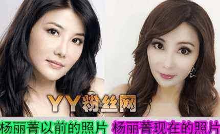 原创中国女版李小龙因拍戏一夜瘫痪如今脸僵似丧尸49岁无人敢娶