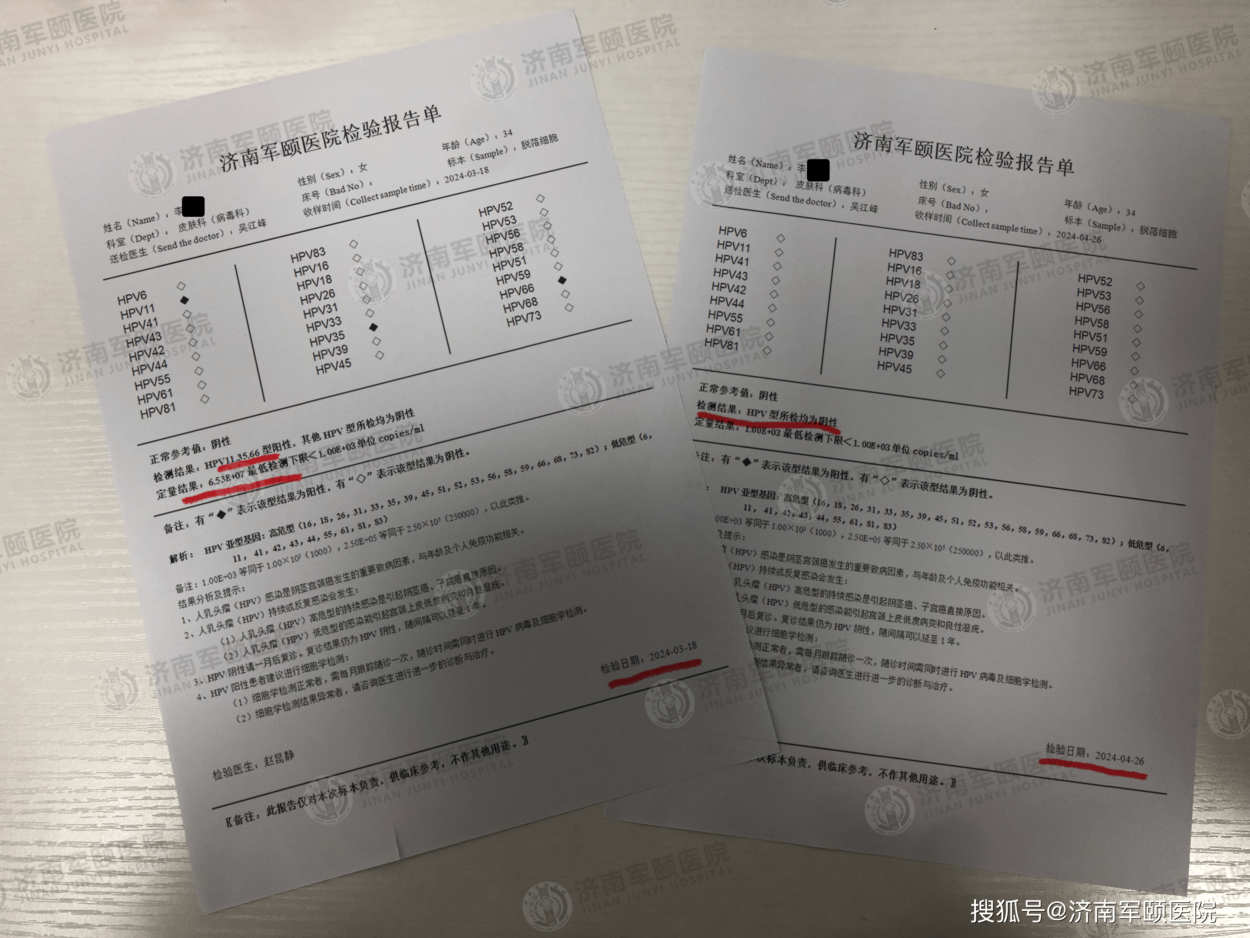 济南军颐医院hpv转阴记录
