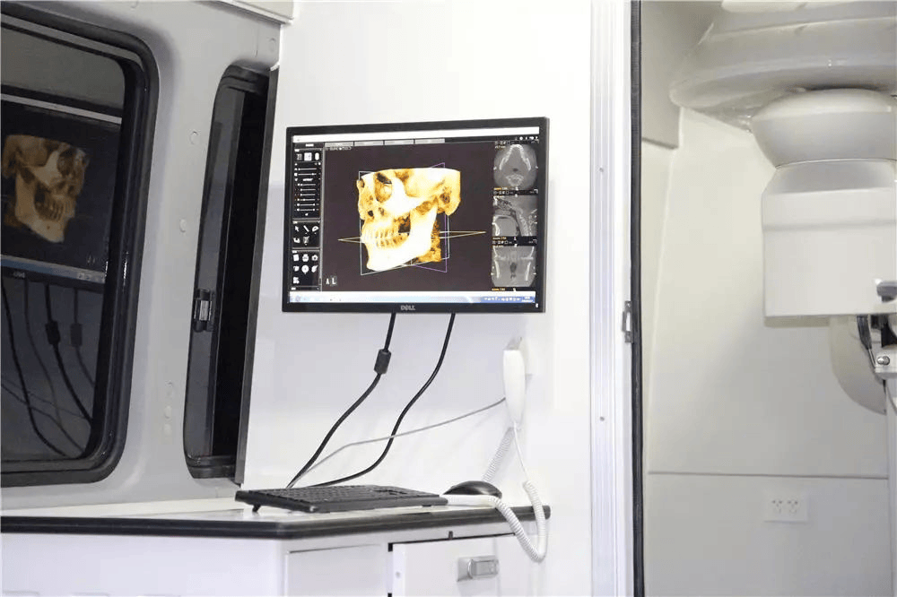 数字化口腔cbct影像车 二手牙科口腔流程诊疗车