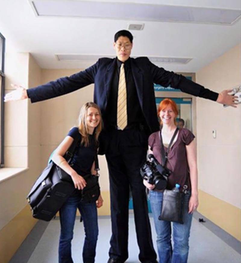 亚洲第一巨人张俊才:身高2米42,比姚明高半个头,结婚22年无子