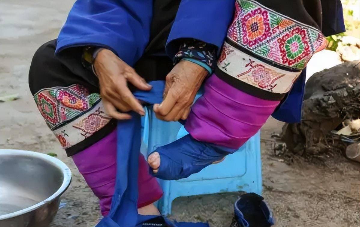 最后一位裹脚女性口述:15岁靠"三寸金莲"嫁大户,洗脚疼到崩溃