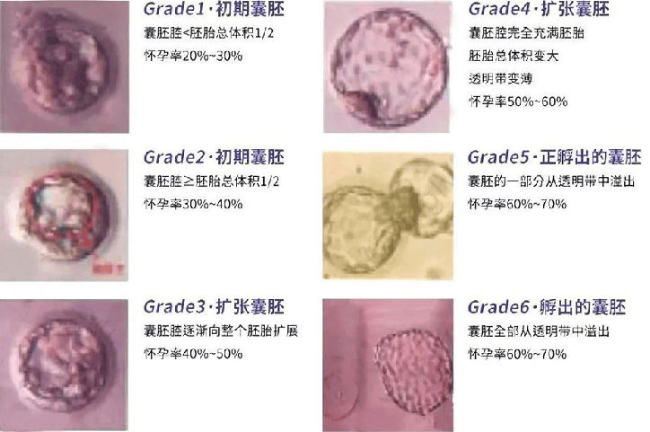 4aa囊胚图片图片