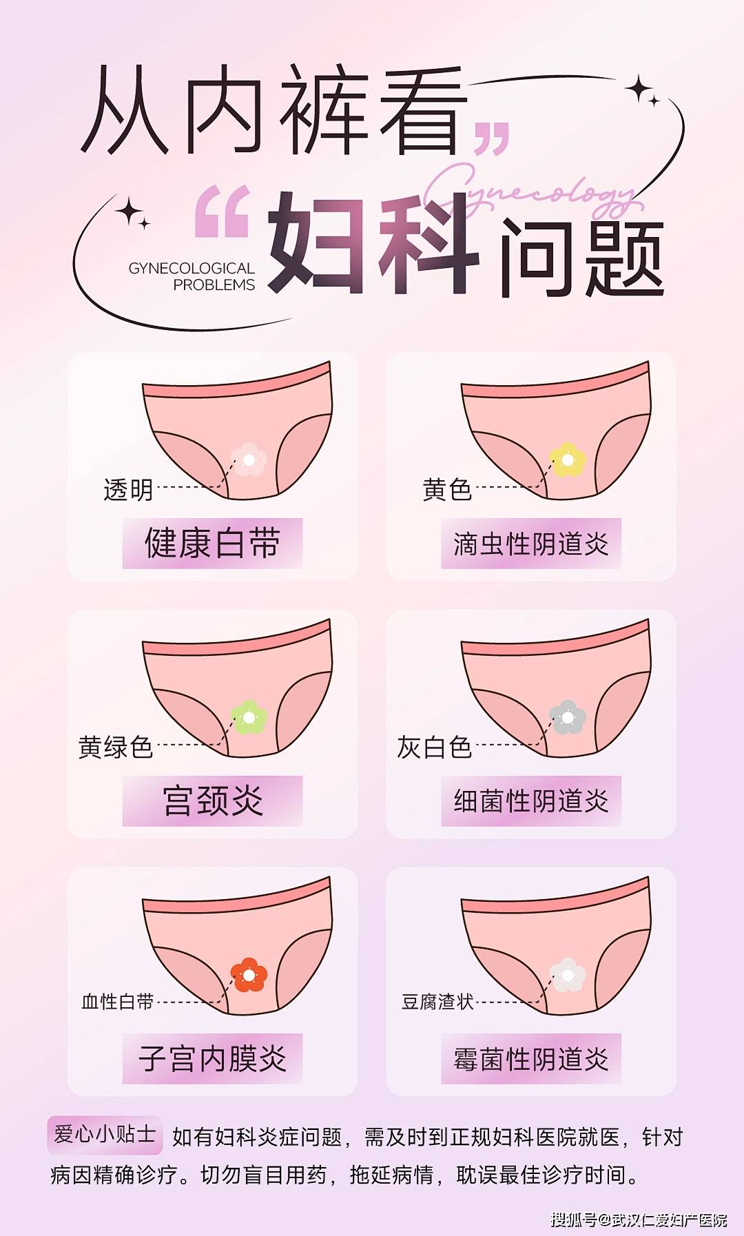 女性分泌物黄黄图片