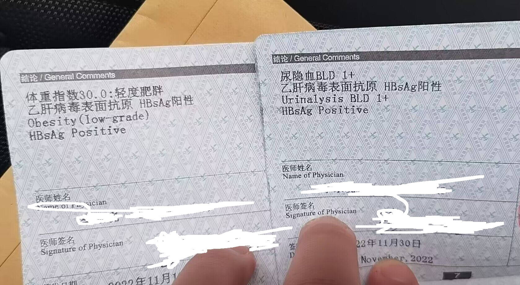 小红本体检记录总之,乙肝携带者在办理出国旅行健康证明时,只要肝功能