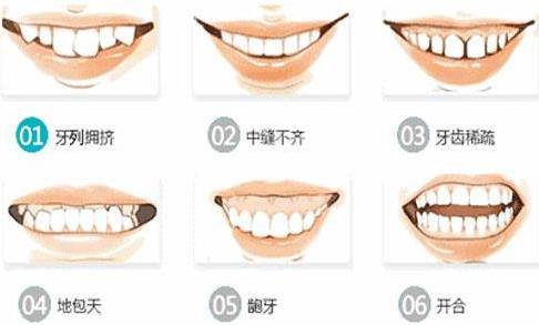 邢台正畸专家王振莉:牙齿整齐不代表咬合正常