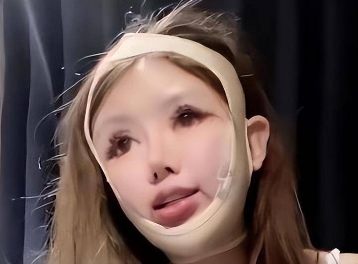 削骨脸上会有疤痕吗_脸削骨_削骨脸会垮吗