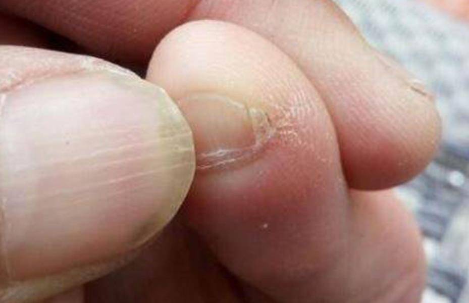 若你的小脚趾有2瓣趾甲,或许不是纯正汉人,而是这一种族的后裔