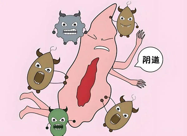 (阴道壁),黏膜慢性炎手术顺利,术后李阿姨安返病房休息.
