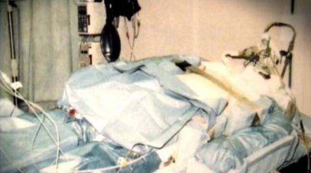 东海村核事故亲历者大内久:每天目睹身体腐烂,83天后去世_核辐射_体