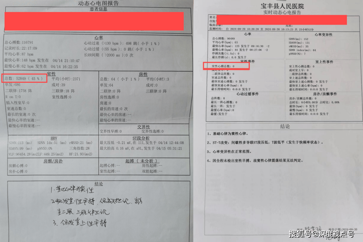 24小时心电图指标解读图片