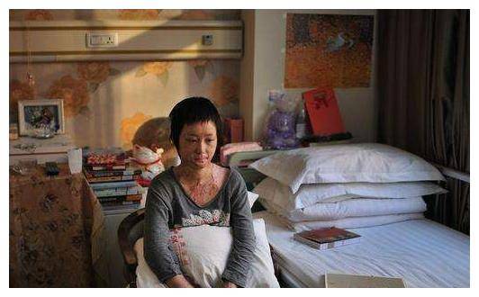 安徽16岁少女因拒绝官二代追求,惨遭报复致毁容,如今生活怎样