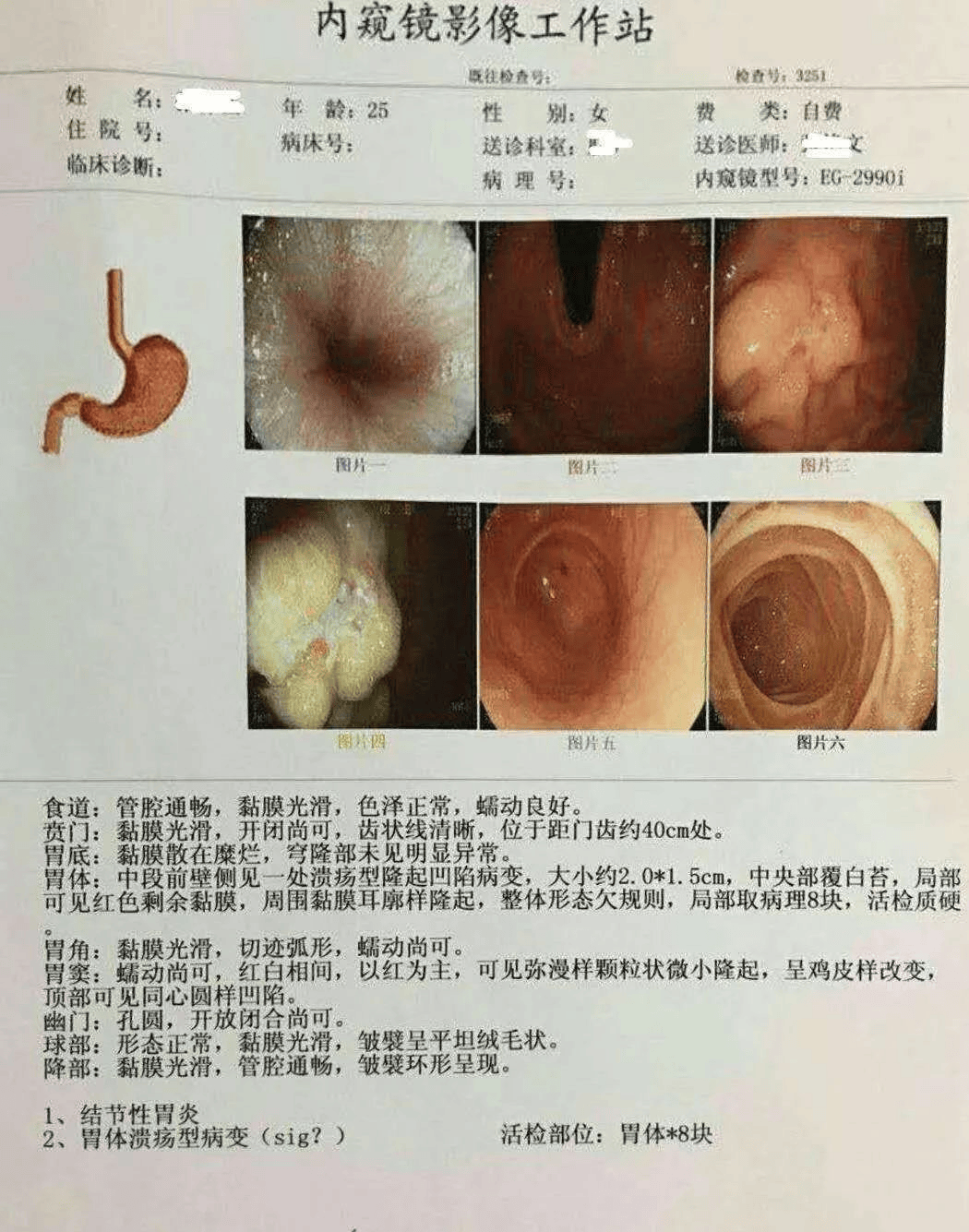 充分充气后