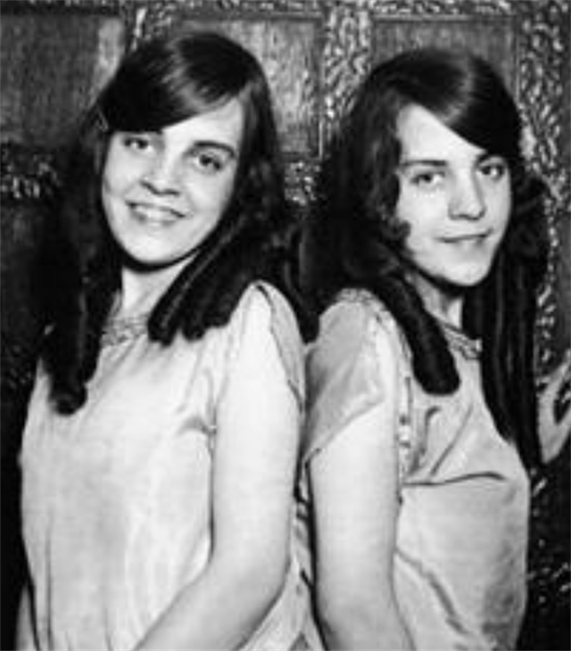 回顾英国臀部连体姐妹:3岁被卖成"摇钱树",虽有丈夫却婚姻不幸