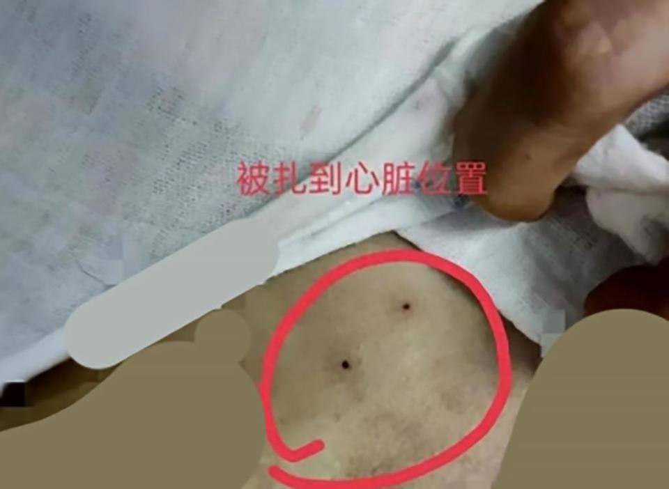 4岁女童"被刺破心脏"身亡,医院:规培生有资质,赔5万!