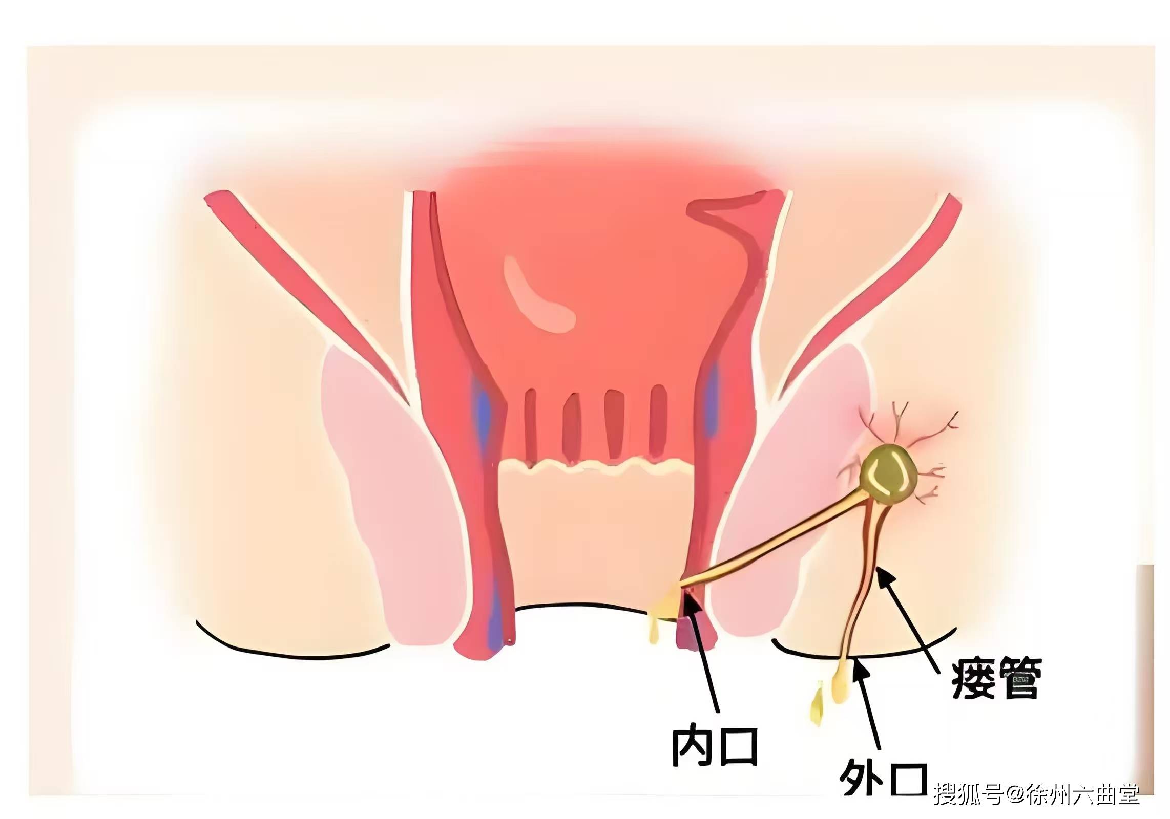 腮瘘是什么位置图片图片