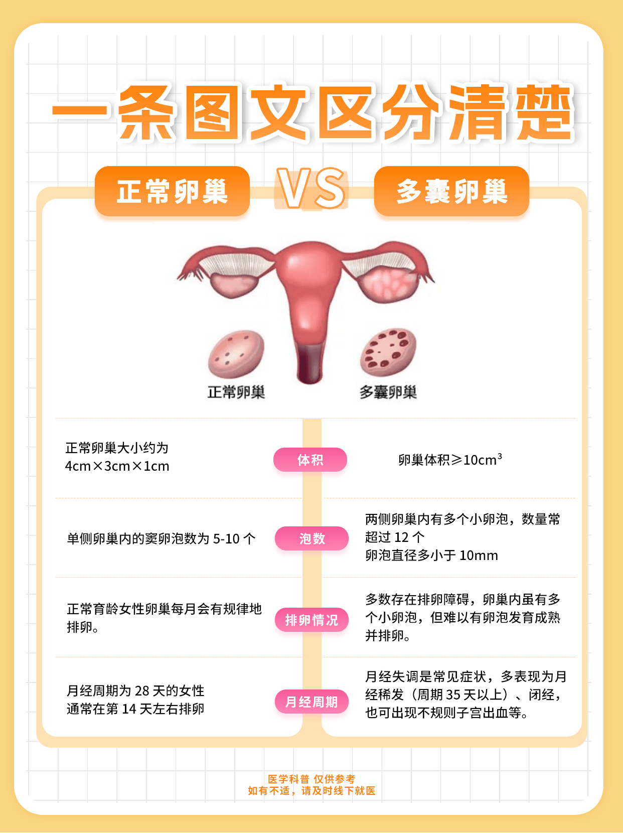 一条图文区分清楚,正常卵巢和多囊卵巢