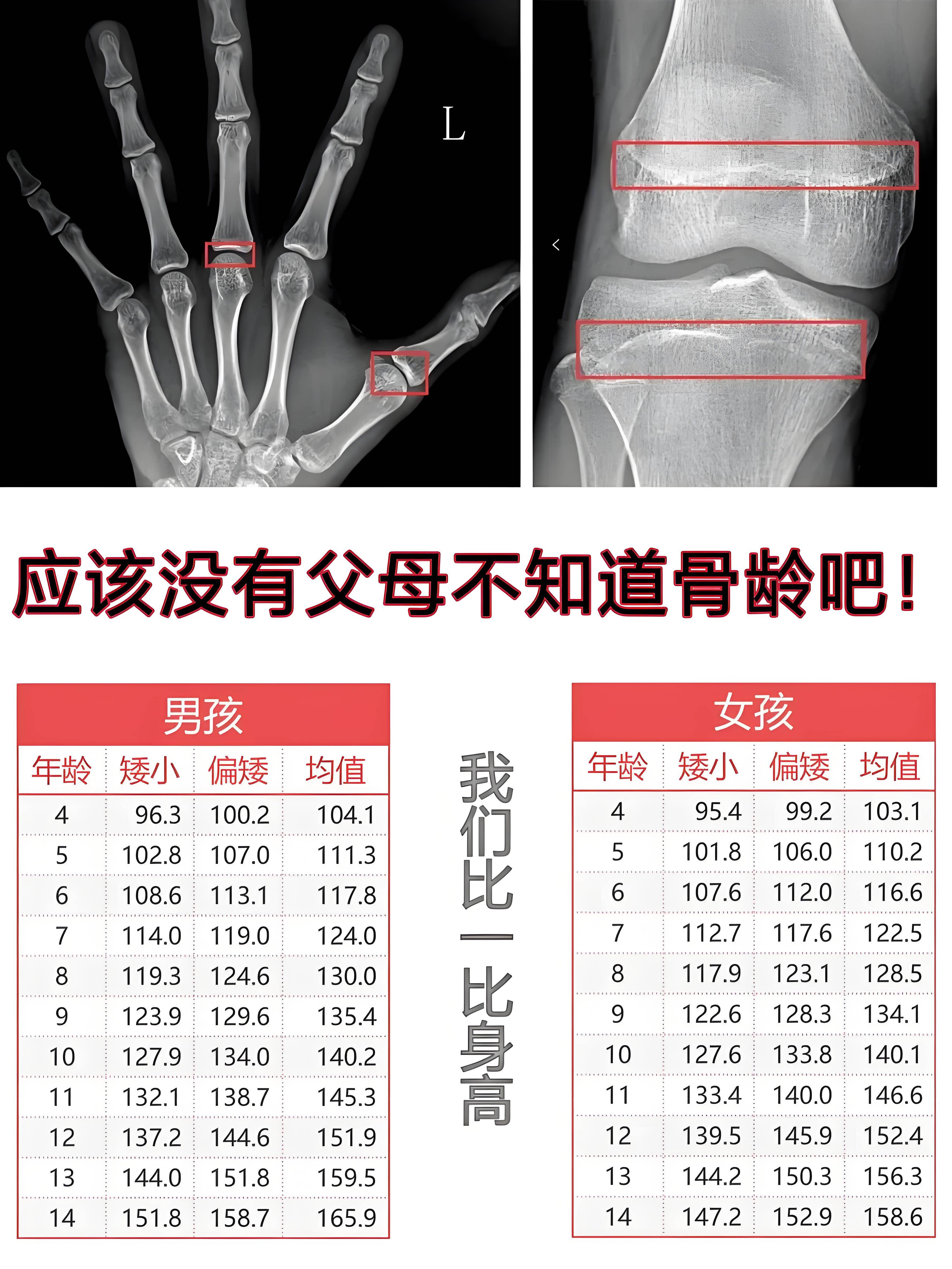 重庆天佑儿童医院纪烈琴医生:孩子骨龄落后1岁多,平时要多吃什么食物?