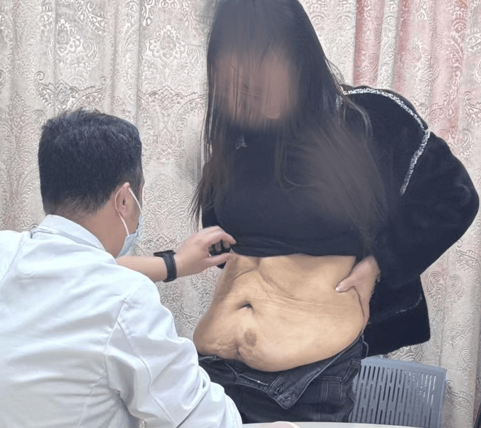 生完孩子瘦不下来的肚子，不一定是胖！