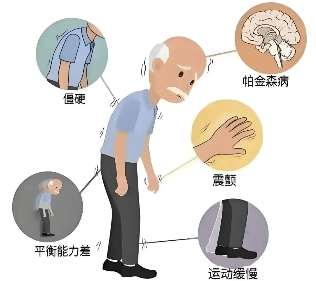 帕金森别乱吃饭，三个饮食禁忌，日常一定要避开丨广州华康医院神经修复医学中心