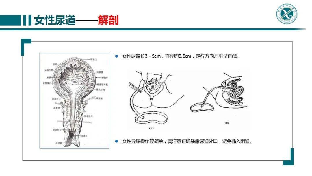 ppt 留置导尿患者漏尿原因分析及护理对策