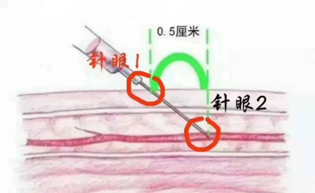 消毒_皮膚_血液