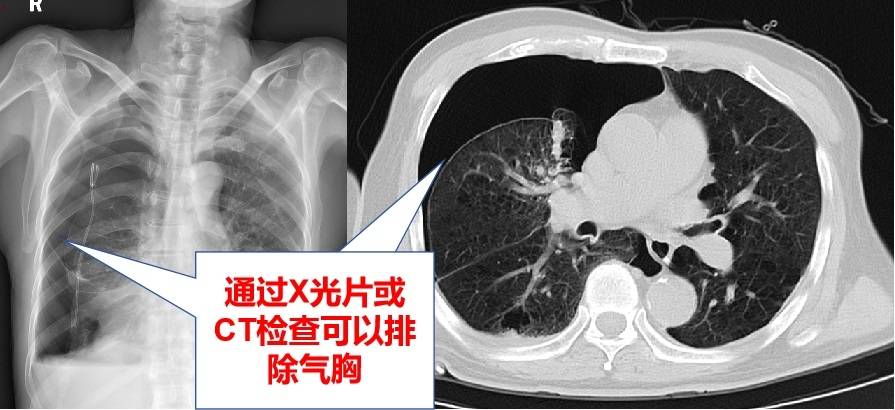 進行_患者_診斷