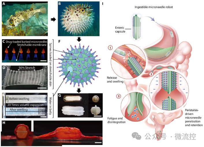 利用腸蠕動驅動的微針機器人,實現生物藥物的無痛口服遞送_研究_進行