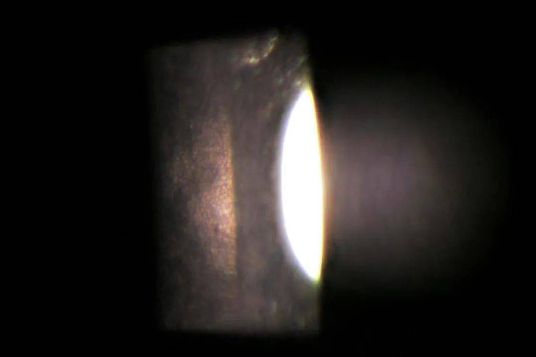 镜面反光照明法0461 主要用于观察前房闪辉61 成像焦点放在角膜和