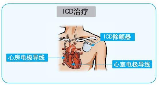 編制床位40張,可開放床位50張,包含心臟監護病房ccu床位6張,配備後