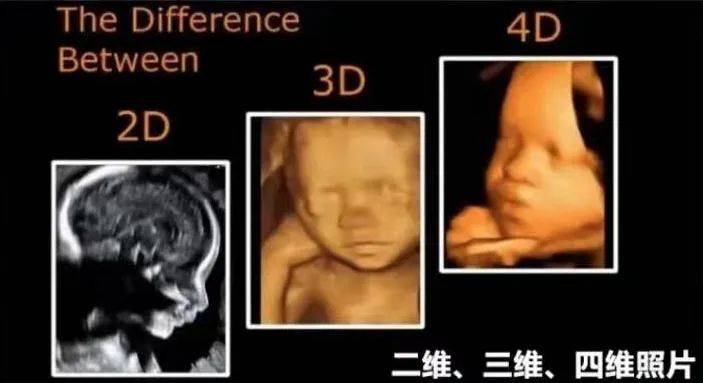 三个月胎儿b超图片
