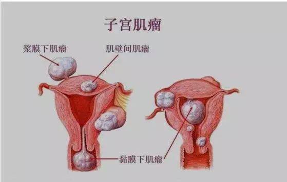 女人子宫实景图片