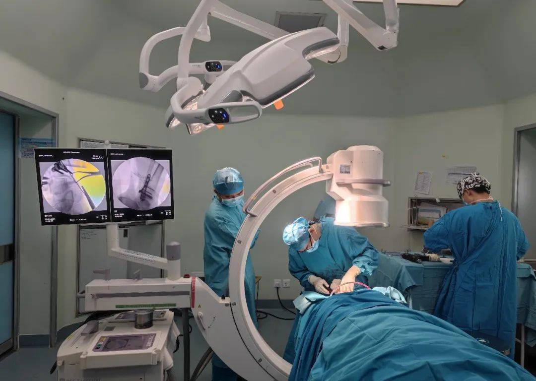移动c型臂x光机是手术室骨科的常用设备之一,c型臂的核心部件分上下两