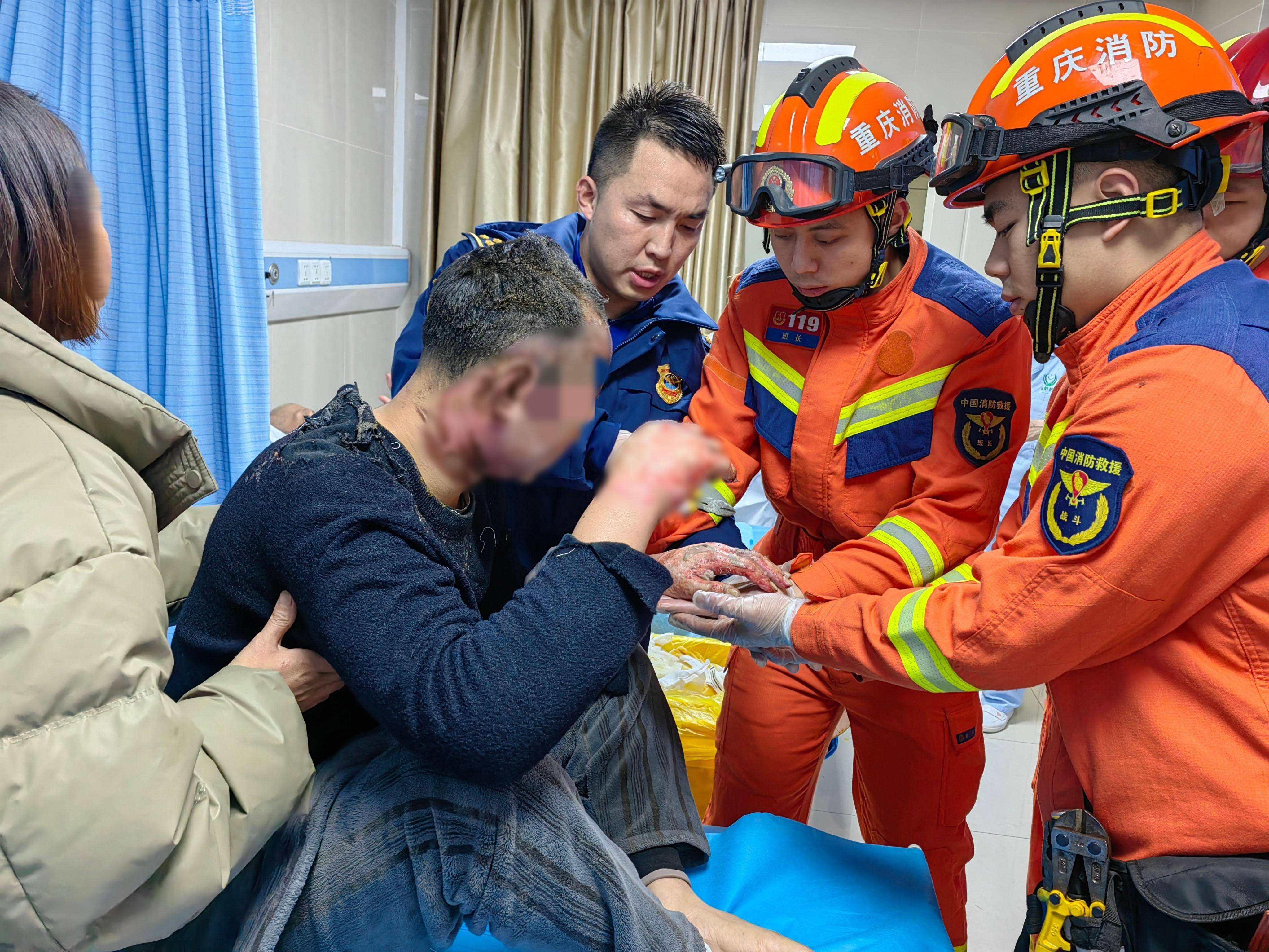 烧伤患者急需手术 求助消防员摘取戒指