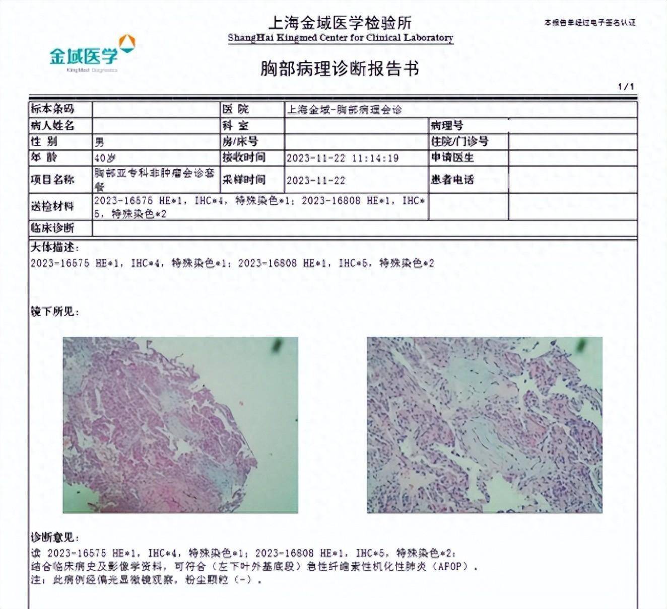 病理报告单图片 模板图片