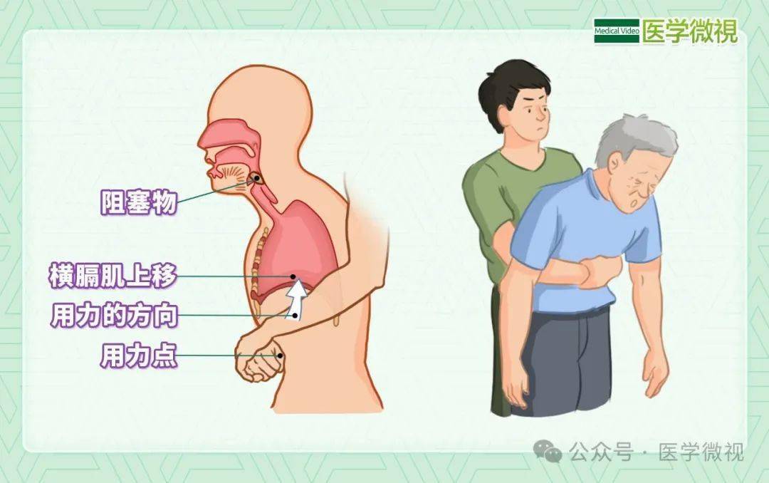 噎呛海报图片