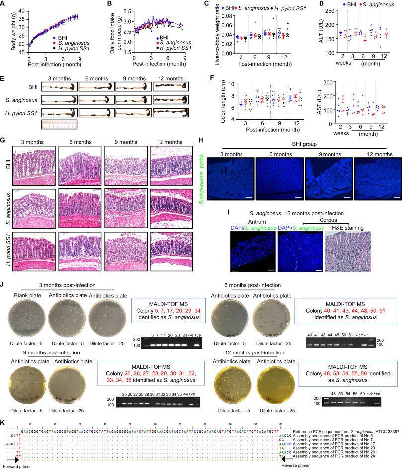 香港中文大學在cell上發表除了幽門螺