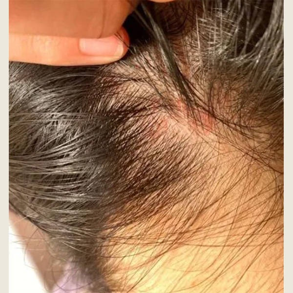 中国品牌洗发水_头皮屑_头发_问题