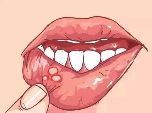 如果接吻的双方同时存在口腔或食道内溃疡,牙龈出血的情况,这个时候