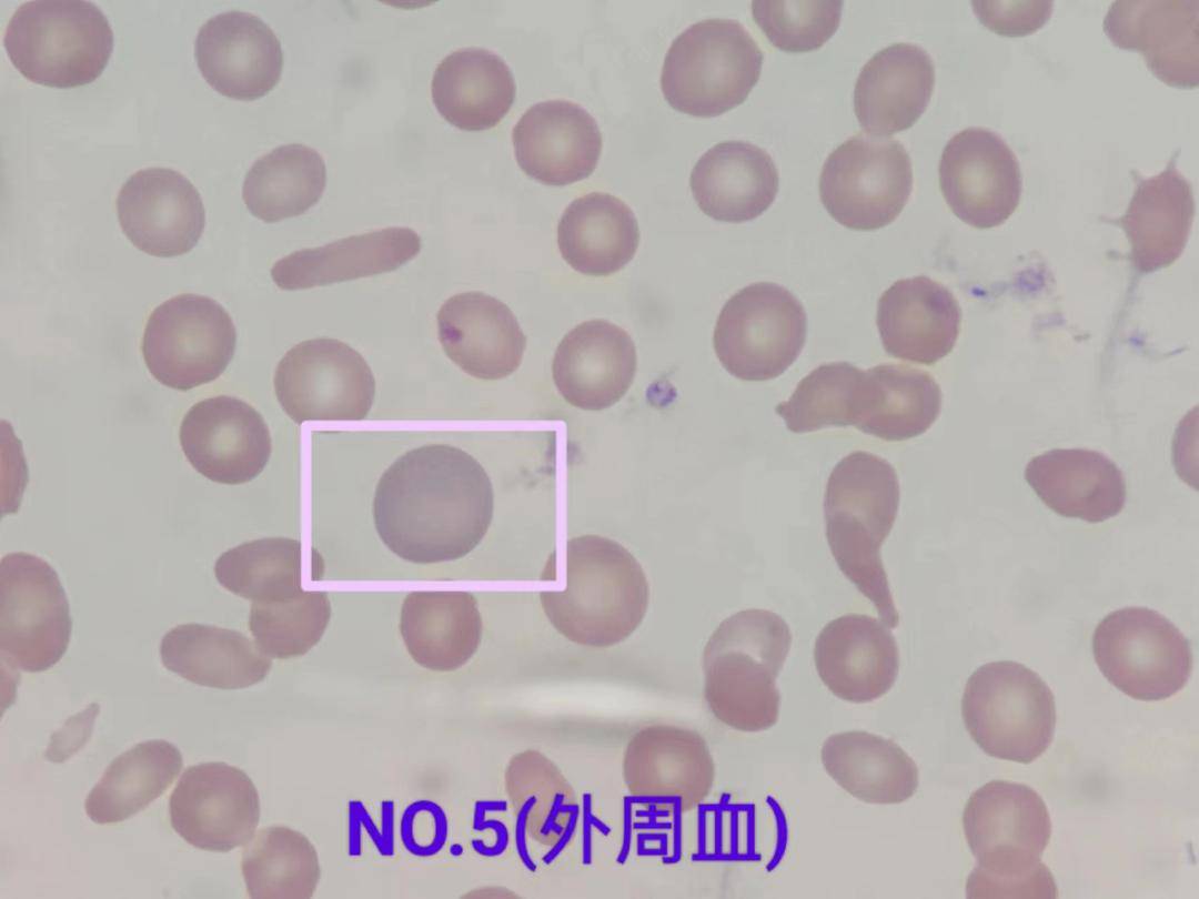 看图识细胞(第125期)_检验_形态学_来源