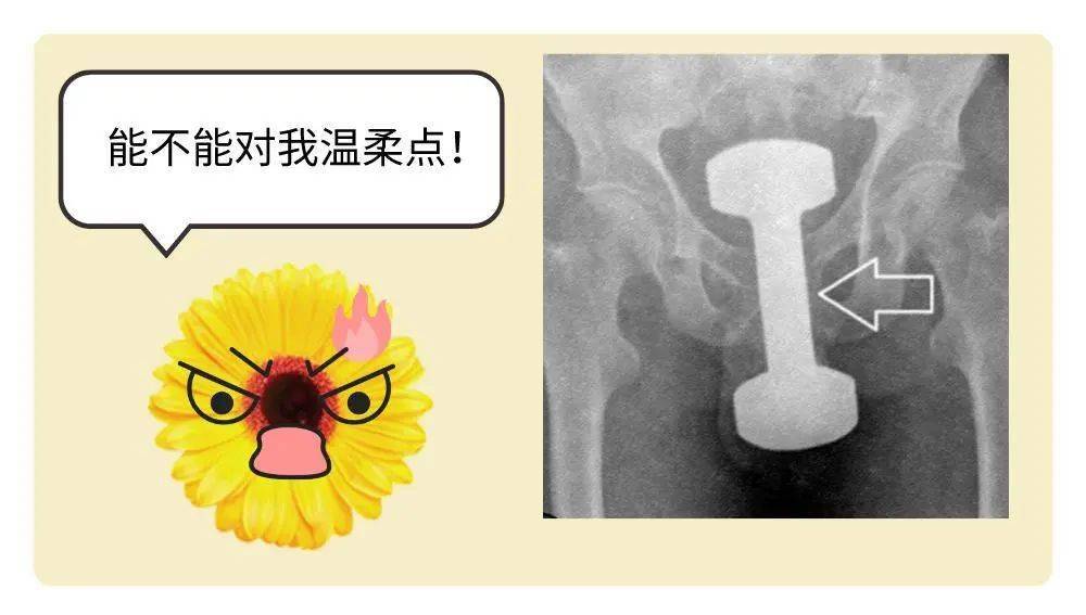 肛门异物怎么取出来图片