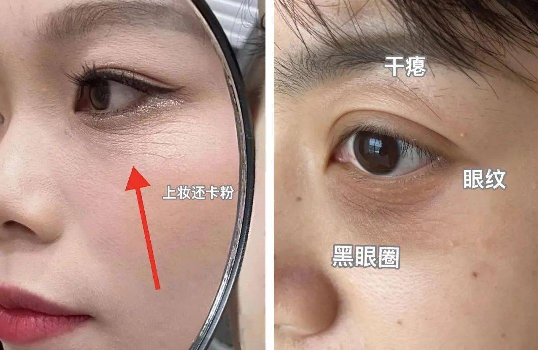 黑森林深处那块会发光的罗盘，让我记住了眼形纹的诡异？