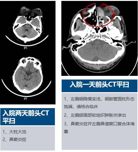 辅助检查