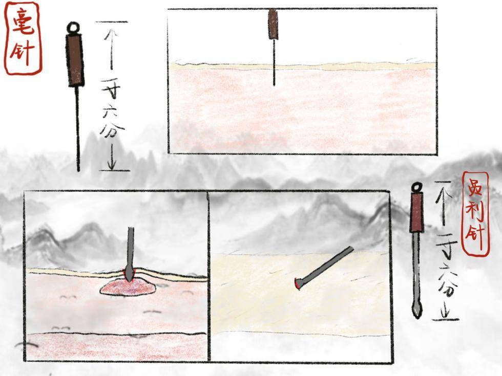 长针又名环跳针,取法綦针长七寸.锋利身薄取远疾,邪气深着功效奇.