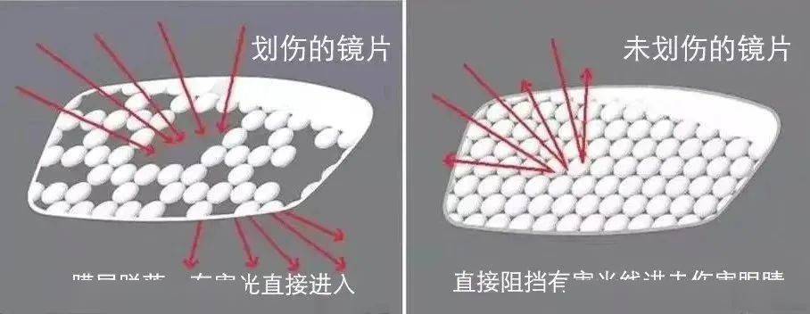镜片刮花也能加深近视度数?_眼镜_防控_儿童