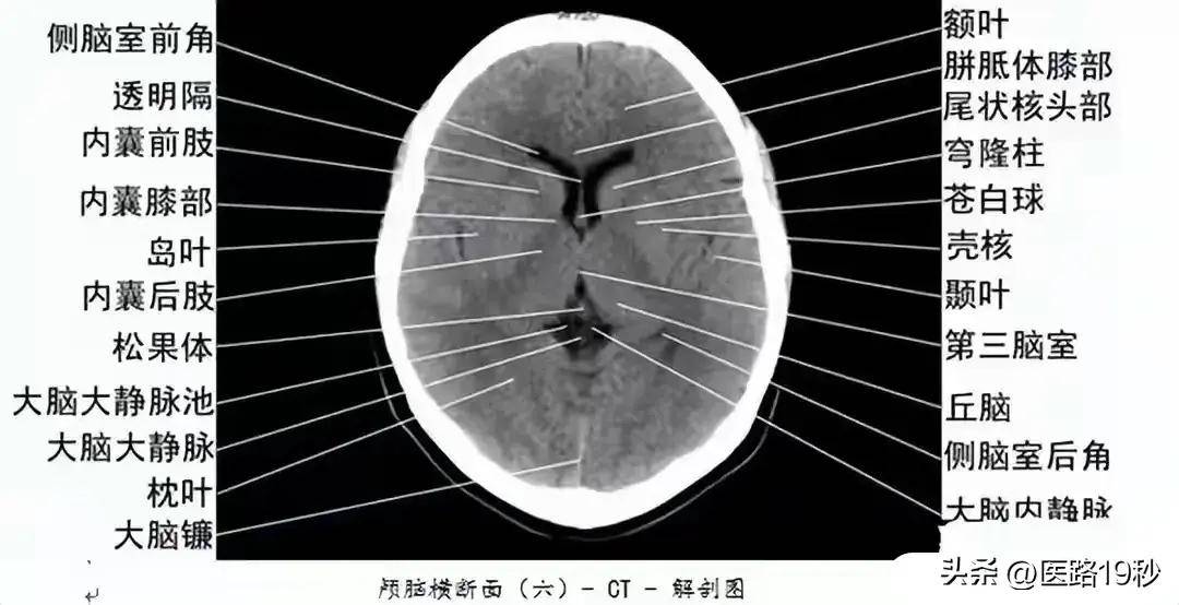 影像科医生整理的影响检查解剖图