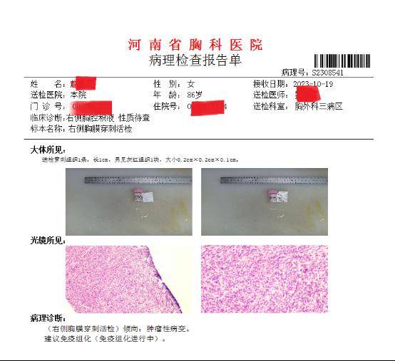 病理报告单 肿瘤图片