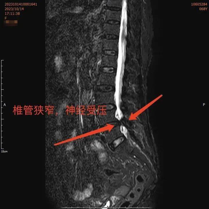 女性做腰部ct尴尬图片