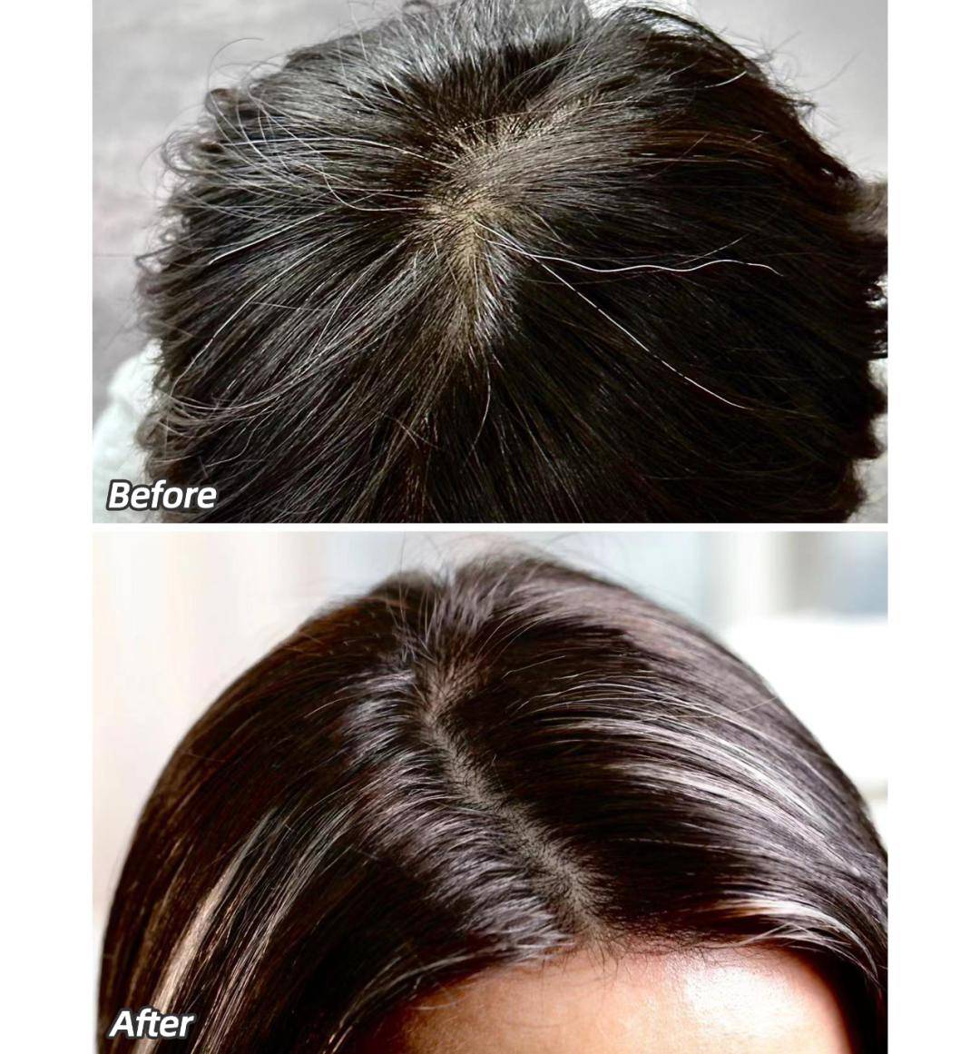 if 团队亲测,实际效果因人而异每人肌肤状态不同,图片仅供参考发际线