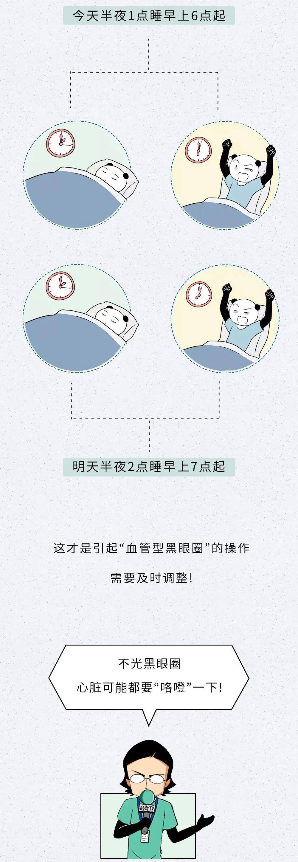 要睡多久觉,才能把黑眼圈睡没?